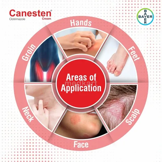 canesten cream 30 gm